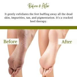 BodyHerbals 1 Minute Pedicure Lemongrass Foot Scrub, 125g