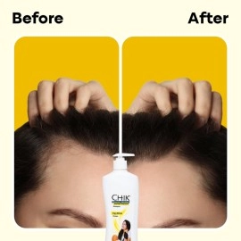 Chik Hairfall Prevent Egg Shampoo, 340 Ml