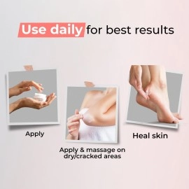 Kaya Skin Clinic Deep Nourish Elbow and Foot Cream, with Shea Butter & Coconut Oil, All Types 50ml