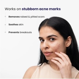 RE\' EQUIL Pitstop Gel for Acne Scars Removal and Acne Pits Removal - 30g