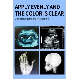 Dehmy ultrasound paper upp 110hd ultrasound machine paper roll/ultrasound paper roll(pack of 5)