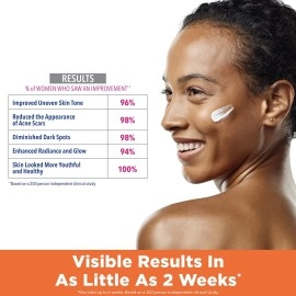 Palmer\'s Skin Success Dark Spot Corrector Fade Serum, 1 Ounce, WHITE, Fl Oz (Pack of 1)