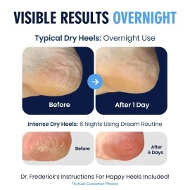 Dr. Frederick\'s Original Moisturizing Heel Socks for Cracked Heel Treatment - 2 Pairs - Stop Cracked Heels in Their Tracks