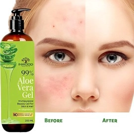 Inwood Organics 99% Pure & Organic Aloe Vera Gel for Face, Skin and Hair with Vitamin E | For All Skin & Hair Types | Multi-purpose Aloe Vera gel | 100% Vegan | Paraben Free - 200 ml