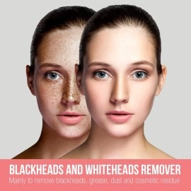 Havells SC5060 Pore Cleanser, Blackhead/Whitehead Remover, 3 Suction Modes - Low/Medium/High, Fast Charge (White)