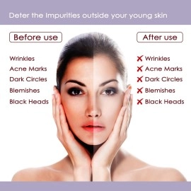 NutriGlow Platinum Diamond Gold and Pearl Facial kit 6-Pieces Skin Care Kit For Women, 250 gm+10ml