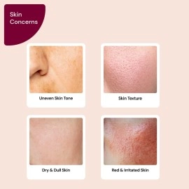 SUGANDA SKINCARE 5% Lactic Acid Serum, AHA Exfoliant with Hyaluronic Acid for Uneven Texture, Removes Dead Skin Cells, Reduces Dark Spots (30ml)