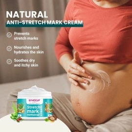 MildCares Stretch Marks Removal Cream (50gm) | For Prevents Stretch Marks, Nourish & Hydrating Skin | With Shea Butter, Saffron, Kokum Butters | All Skin Types | Stretch Marks Cream For Women