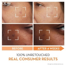 Olay Luminous Niacinamide + Vitamin C Face Cream Moisturizer 50G, 50 g (Pack of 1)