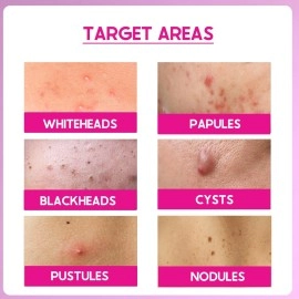 Cos-IQ 25% AHA + 2% BHA + 6% PHA Peeling Solution for Face | 10-Minute Facial | Chemical peel for face for glowing skin | Exfoliating serum| Men & Women | At-home facial | 30ml