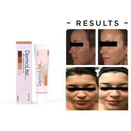 Dermolite Original Skin Whitening And Brightening Cream For Dark Spot, Blackheads For All Types Of Skin With No Paraben For Women And Men - 20 Gm