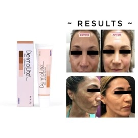 Dermolite Original Skin Whitening And Brightening Cream For Dark Spot, Blackheads For All Types Of Skin With No Paraben For Women And Men - 20 Gm