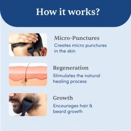 Man Matters Advance Derma Roller For Hair & Beard | 540 Micro 0.5mm Titanium Alloy Needles | Beard Health and Development | Stimulates Beard Hair Follicles | Safe, Easy & Effective To Use