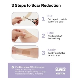 AWD Medical Silicone Scar Sheets Medical Grade Soft Silicone Gel Tape for Scar Removal (1.6 x 60) - Pack of 3
