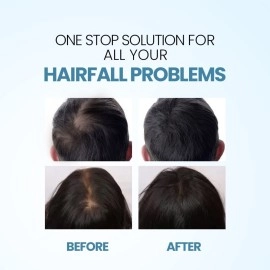 Nature Sure Jonk Tail Hair Oil for Men and Women - 2 Packs (150 ml Each)