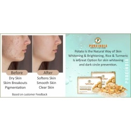 PureIndia Potato Rice Soap for Natural Skin Whitening and Pigmentation, Minimizes Open Pores, Removes Impurities | The Natural Way of Skin Whitening 100-gm Pack of -1