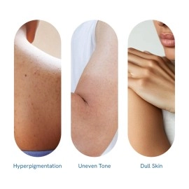 Be Bodywise 5% Niacinamide Body Wash | Prevents Body ACNE I Fights Hyperpigmentation, Deep Cleanses & Hydrates skin | Glowing & Hydrated Skin | Aloe vera, Vitamin B3 & E | All Skin Types | 250 ml