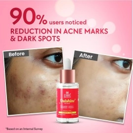 Chicnutrix Outshine - with Korean 2% Niacinamide + Glutathione + Vitamin C | Helps Brighten Dull Skin, Clears Dark Spots, Blemishes, Acne Marks & Pigmentation | Korean Glass Skin Serum