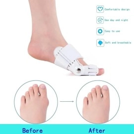 KLIFFOO Toe straightener bunion corrector for women & men 2 pcs splint with toe fracture support and foot support for pain relief toe separator Orthopedic Tight Fitting Band Support