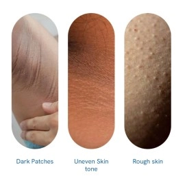 Be Bodywise Pigmentation Repair Cream 100 g | With 0.1% Retinol, 2.5% Lactic Acid, 0.5% Kojic Acid & 2% Urea | Hyperpigmentation Removal Cream | For Dark Neck, Ankles, Knuckles, Armpits, Thighs &