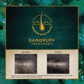 Indulekha Svetakutaja (Dandruff Treatment) Hair Oil 100ml