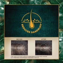 Indulekha Dandruff Treatment Shampoo 580 ml