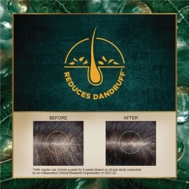 Indulekha Dandruff Treatment Shampoo 340 Ml