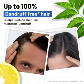 SESA Ayurvedic Anti Dandruff Shampoo With Neem, Lemon Helps Reduce Hairfall Controls Dandruff, 500Ml