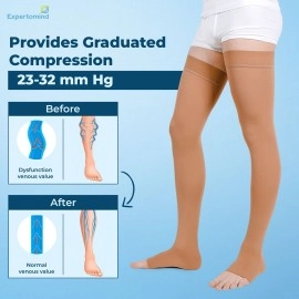 Expertomind Compression Stockings for Women and Men | Class 2 Thigh Length Medical Socks for Varicose Vein and Leg Pain Relief | 23-32 mm Hg | Compression Socks, Pair of 2, Beige