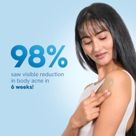 Be Bodywise Strawberry Skin Pack | With 1% SA Body Wash, 5% Lactic Acid Body Lotion & 10% AHA Scrub | Exfoliates, Reduces Body Acne, Strawberry Skin & Uneven Skin Texture | 650ml