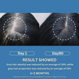 BLUSHLIN SCIENCE MEETS SKIN 2% Darkenyl For Anti-Greying Hair Serum|Hair Growth Actives With Biotin,Bhringraj,Henna&Amino Acid Complex|Strengthens Roots&Adds Shine|Toxin Free|All Hair Types- 30Ml