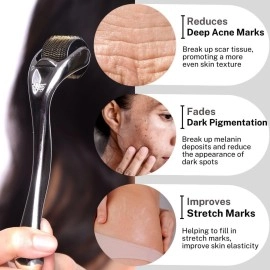 HOUSE OF BEAUTY Derma Roller for Face - 0.75mm Microneedle Roller for Skin Care, Dark pigmentation, Beard Growth & Hair Regrowth - 540 Real Titanium Microneedling Tool for Glowing Skin, Fine Lines