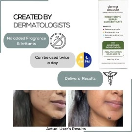 Derma Decode 10% Azelaic Acid Serum with Kojic Acid | Reduces Acne Marks, Pigmentation, Dark Spots, un-even Skin Tone | Calms Redness/Inflammation & Improves Textrure- 30ml