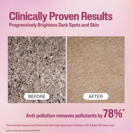 Cetaphil Bright Healthy Radiance Gentle Renewing Cleanser|100G|Gentlebright Technology With Vitamin E-Releasing Jojoba Beads|3In1: Brightening,Gentle Exfoliation And Anti-Pollution|Fragrance Free