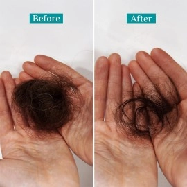 Pilgrim Spanish Rosemary & Biotin Anti Hairfall Shampoo for Reducing Hair Loss & Breakage 200ml | Rosemary shampoo for hair growth | Upto 95% stronger hairs | For all hair types | For Men & Women