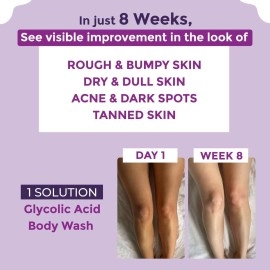 Sanfe Clear & Confident Glycolic Acid Body Wash | AHA Exfoliation for Rough & Bumpy Skin, Tan, Acne & Strawberry Skin | Smooth Skin from 1st Use | 250ml Daily Shower Gel