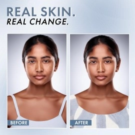 ThriveCo 10% Vitamin C Serum For Face With Hyaluronic Acid | Gives Instant Brightening Effect & Glowing Skin | For Men & Women | All Skin Types | Non-Sticky, Vegan, Fragrance & Cruelty-Free | 30ml