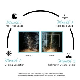 Rootcos Salicylic Acid Anti-Dandruff Serum with Piroctone Olamine | Scalp Serum for Exfoliation, Dandruff, Flaky, Itchy scalp | Post Wash Treatment | For Men & Women | 50 ml