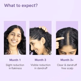 Be bodywise Anti Dandruff Scalp Serum 50ml | Fights Dandruff, Reduces flaky & itchy scalp | With Ichthyol Pale, Zinc Pyrithione, & Tea Tree Oil | Paraben & Sulphate free