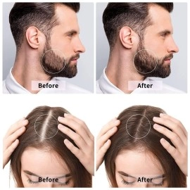 BHUMLO Derma Roller For Beard Hair Skin Face 540 Titanium.25Mm - Self Care Gifts Facial Skin Care Tools, Hair Scalp Massager Shampoo Brush With Soft Silicone Bristles Comb Scrubber