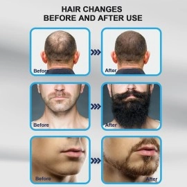 YBROY Derma Pen Stamp For men and Women | Microneedle Pen for Body & Hair & Beard Growth - Adjustable Microneedling Stamp For Skin - 0.5mm - 3mm Titanium Micro Needle Derma Stamp For Skin Care