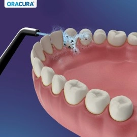 ORACURA Pack of 2 Black Standard Tip for OC150, OC001, OC100, OC010, OC200 & OC450 Water Flossers