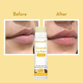 WishCare Ceramide Lip Balm with SPF50 PA+++ - Kojic Acid & Niacinamide - For Lip Lightening & Protection 5gm