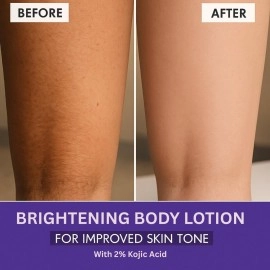 BAKE 2% Kojic Acid Body Lotion with Niacinamide & SPF 30 PA+++ for Pigmentation & Tan Removal | For Dark Spots & Sun Protection | Tanned & Pigmented Skin | For Women & Men | 200ml