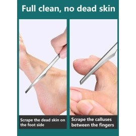 Pedicure Set, 5 Pieces Pedicure Knife Set with Storage Case,Dead Skin Corn Foot Callus Remover, Professional Foot Repair Tools Kit with Sharp Blade,Nail Knives for Ingrown Toenails Home Beauty Salon