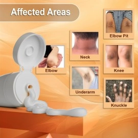 COZMIX Derma Re-White Dark Patch Removal Cream | Knee & Elbow Cream | Neck & Underarm Cream | Dark Patches Corrector | Underarm Whitening Cream | Fades Pigmentation & Uneven Skin Tone, 80 gm