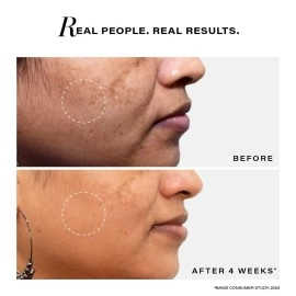 Novology Pigmentation Reduction Serum | Bi-Phasic Face Serum for Dark Spots and Hyperpigmentation | With Niacinamide + Pro-Retinol + Hexylresorcinol