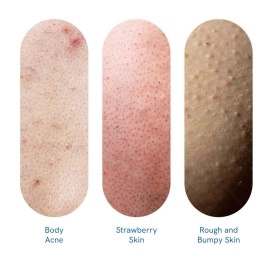 Be Bodywise 1% Salicylic Acid Body Wash Shower Gel | For Body Acne, Strawberry Skin | Infused with1% Salicylic Acid, Camomile extract, Pentavitin | Non-Drying, Paraben Free I All Skin Types I 700 ml