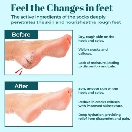 Murti Export Moisturizing Silicone Gel Socks (1 Pair) for Men & Women gel socks for dry cracked feet crack heel repair socks foot moisturizer socks Spa Gel Socks Natural Oil & Vitamin E (Multicolor)