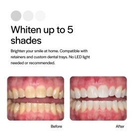 Opalescence PF 10% Teeth Whitening 8pk (Latest Product)